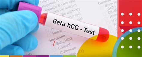 beta hcg lavoisier,como solicitar beta hcg